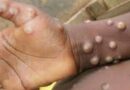 Monkeypox: Experts give virus variants new names